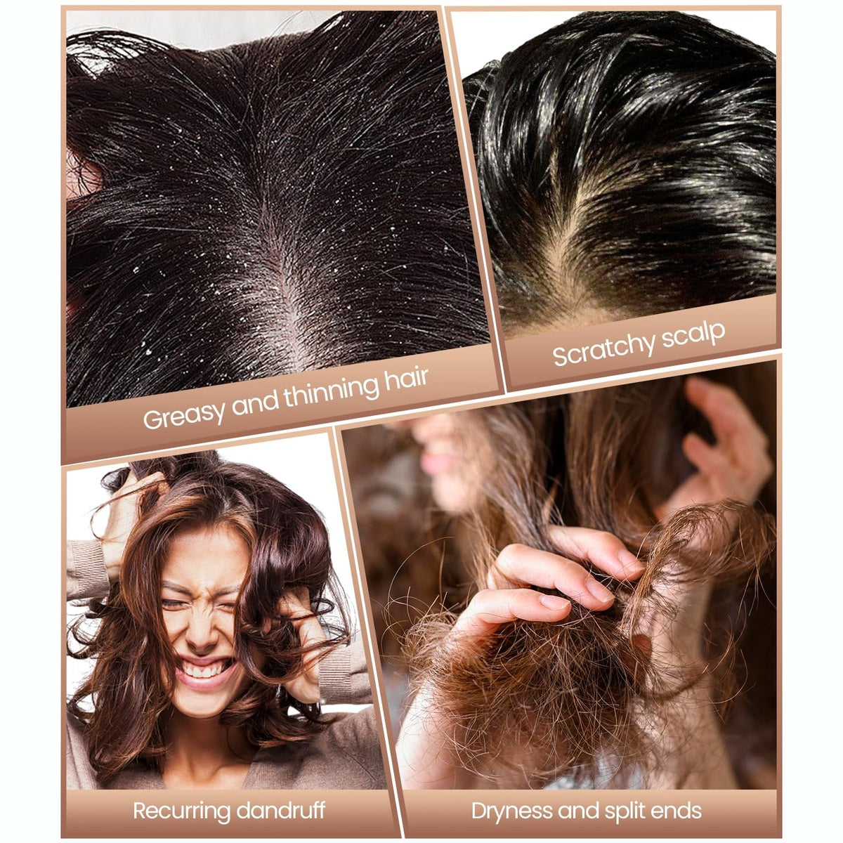 Dandruff Comb Set